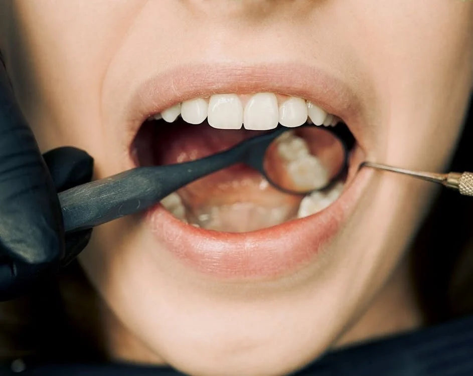 6 Tips for Healthy Gums: Expert Guide to Prevent Gum Disease