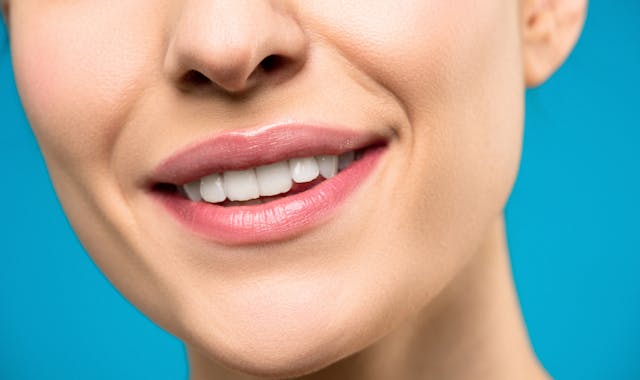 Achieve a Radiant Smile with Drive Dental’s Great White Whitening System